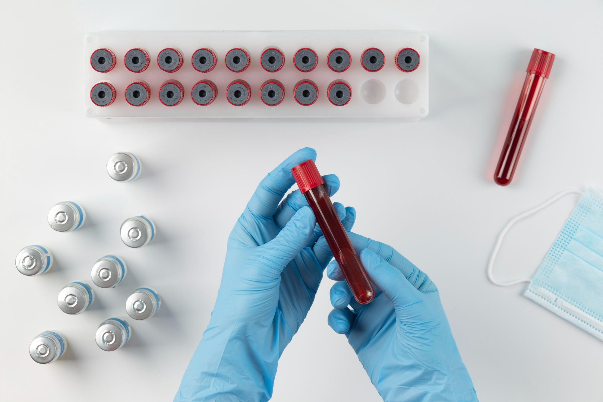 Quais os tipos de exame de sangue mais comuns?